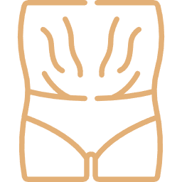 Stretch Mark Treatment